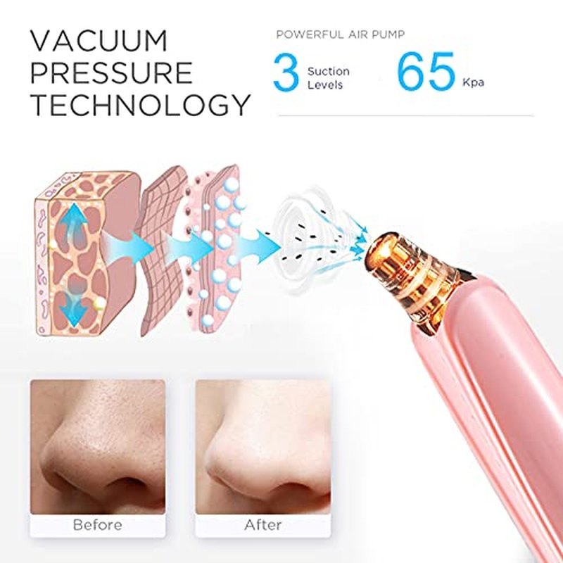 Blackhead Remover Pore Vacuum Cleaner - Upgraded Facial Pore Cleaner - Electric USB Pore Vacuum with 5 Probes - Upgraded Blackhead Suction Tool - Blackhead Remover Kit (Pink)