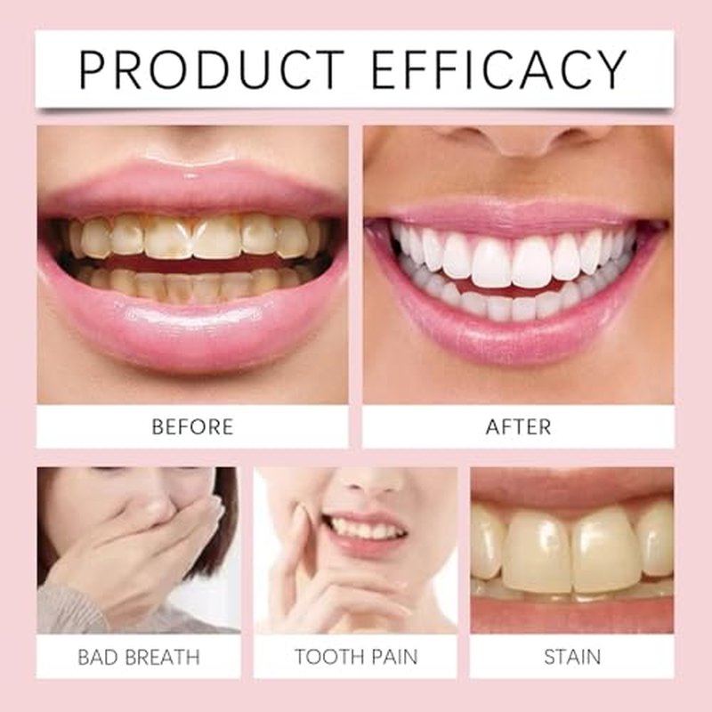 Sp6 Probiotic Toothpaste, Sp-6 Probiotic Toothpaste, Sp-6 Toothpaste, Sp6 Ultra Whitening Toothpaste, Sp-6 Toothpaste Oral Health Management, Fresh Breath(1pcs)