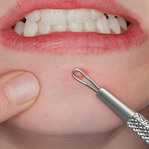 Suvorna White Head Remover for face Tool - Whitehead Extractor Tool - Nose Whitehead Remover Tool - Double Loop Whitehead Remover for face - White Head Remover for Nose
