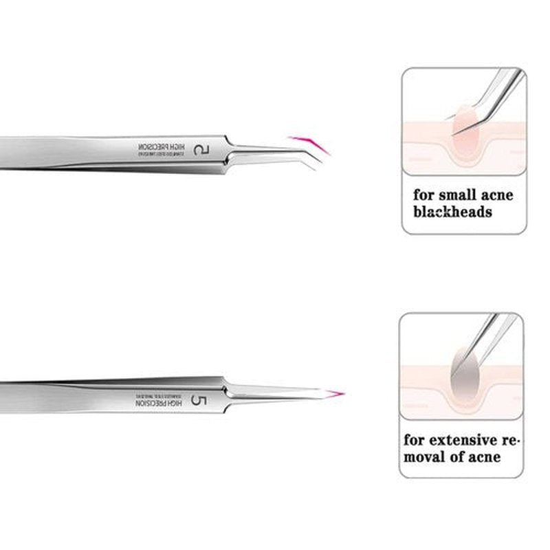 Blackhead Remover Pimple Popper Tool Kit,6 Pcs Acne Comedone Zit Blackhead Extractor Tool for Nose Face,Stainless Steel Whitehead Popping Removal Tool Set