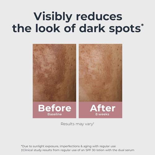 Eucerin Radiant Tone Dual Serum Dark Spot Corrector, Dark Spot Serum with Thiamidol and Hyaluronic Acid, Helps Visibly Reduce the Look of Persistent Dark Spots, 1 Fl Oz Bottle