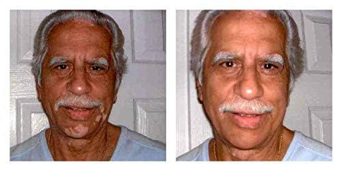 Judith August Killer Cover - Light/Medium - Cover Bruises, Tattoos, Age Spots, Vitiligo & More