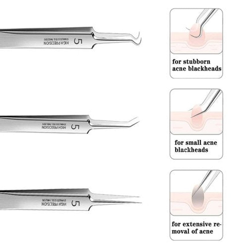 Professional Facial Blackhead Remover Tweezers,3Pcs Precision Pimple Popper Tool Kit for Whitehead Ance Blemishs Comedones Stainless Steel Makeup Tool - Glossy