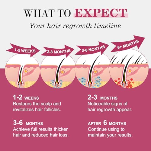 5% Minoxidil for Women Hair Regrowth Spray, hers hair regrowth treatment Infused with Biotin, Extra Strength Treatment to Combat Hair Loss and Thinning, 6 Bottles£¨100 Ml)