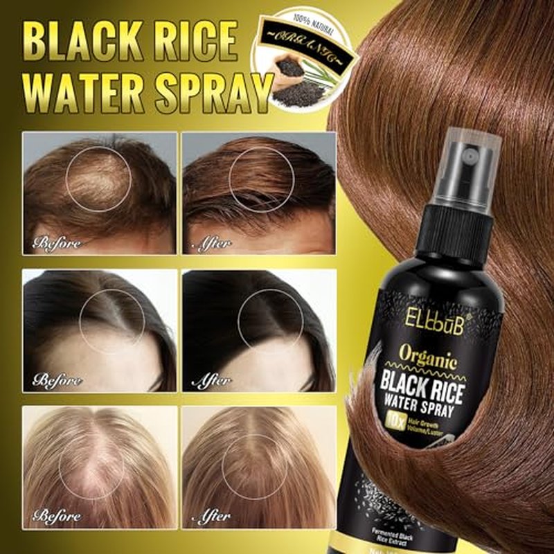 Black Rice Water Hair Growth Serum Spray - Natural Vegan Hair Regrowth Treatment for Men & Women with Castor Oil and Ginger - Ideal for Damaged, Dry Hair - Enhances Thickness, Length, Luster