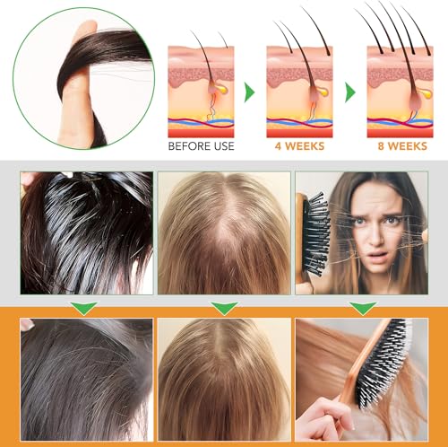 Biotin Shampoo and Conditioner for Hair Loss| Thickening Hair Products with Rosemary, Black Castor & Batana Oil - Strengthens, Repair, Add Shine for Women Curly, Straight, Dry and Damaged Hair