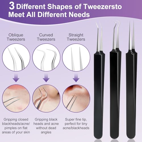 Pimple Popper Tool Kit,10 Pcs Professional Blackhead Remover Comedones Extractor for Easy Removal for Pimples,Blackheads,Zit Removing, Facial and Nose, Acne Removal Kit with Metal Box (Black)
