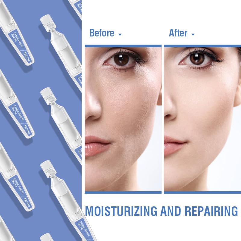 BACHERI Ectoin Repair Face Serum Ampoules # 15 Pcs/Box - Deep Moisture & Anti-Aging Serum with Beta-Glucan, Glycerin, and Hyaluronic Acid – Hydration, Soothes & Protects All Skin
