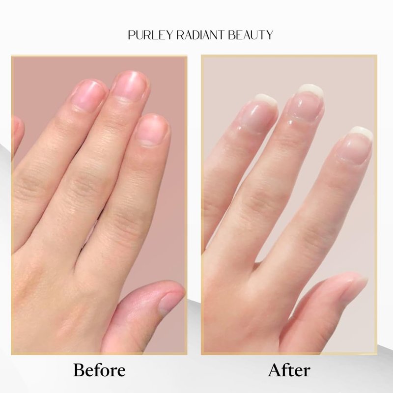 Purely Radiant Beauty Nail Growth Oil – Natural Cuticle Serum for Stronger Nails & Healthy Growth | Jojoba, Castor, Coconut & Argan Oils | Prevents Breakage, Peeling & Brittleness (3ml)