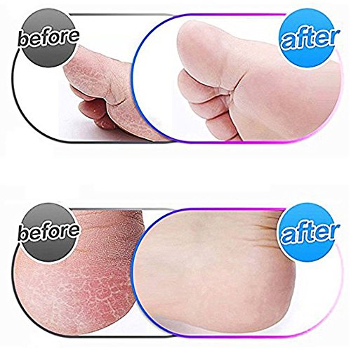 4 Pack Blue Replacement Roller Compatible with Scholl Express Pedi Foot Smoother-Extra Coarse