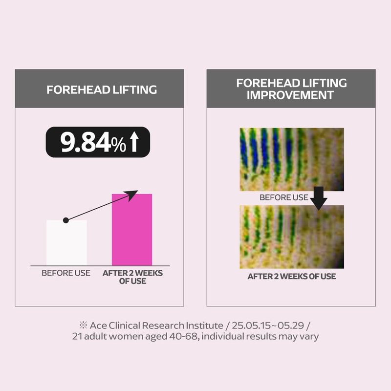 EUNYUL Ring Collagen 20% Face Serum (1.18 fl.oz / 35ml) – Korean Collagen Serum with 200,000ppm Collagen, Peptides & Niacinamide, Hydrating & Firming Skin Care