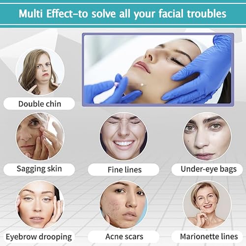 ESTEVO PDO Mono Threads Lift, for Face and Body PDO Thread For Skin Tightening and Reduce Wrinkle (20PCS-26G*50mm)
