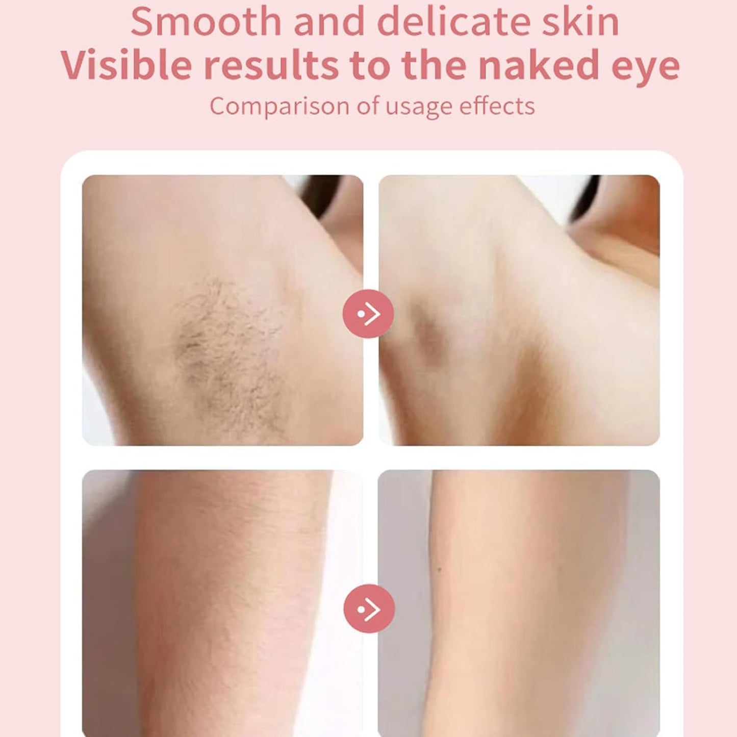 ENVGSOMP Silkglide Pro - 2024 Best Silk Glide Razor, Silk Glide Epilator Painless Hair Removal at Home, 2 in 1 Electric Shaver Razors for Women, Wet & Dry (Pink)