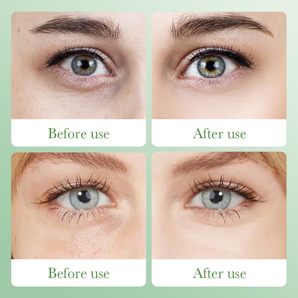 BEUKING Aloe Vera Eye Masks - 60 PCS Under Eye Patches for Puffiness & Dark Circle, Moisturizing Firming Eyes Gel Pad Patches for Bag Puffiness Daily Skincare, Gifts for Women