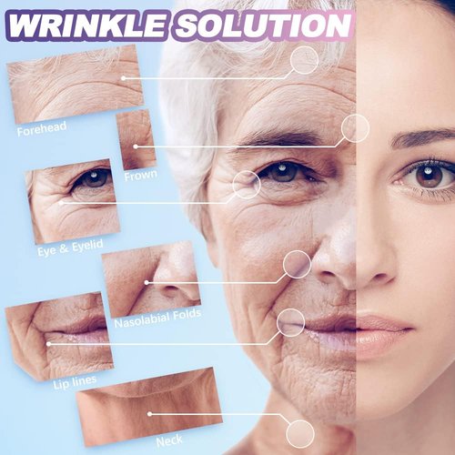 Sfuchin Wrinkle Patches, 160 PCS Face Tape, Pre Cut Kinesiology Full Face Tape for Wrinkles, V Line, Forehead, 11's, Frown, Eye, Lip - Neck Wrinkle Pads, Overnight Used High Elastic Facial Tape