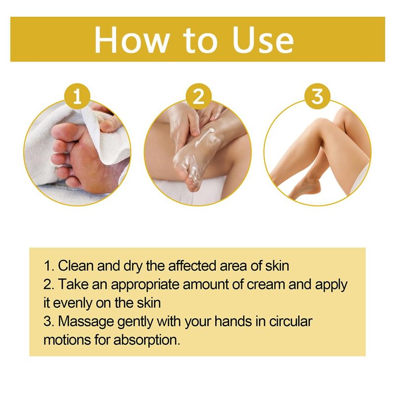 etitek 2PCS Bee Venom Varicose Veins Cream for Legs,Moisturizing Leg Creams Natural Ingredient Leg Care 4oz/120g