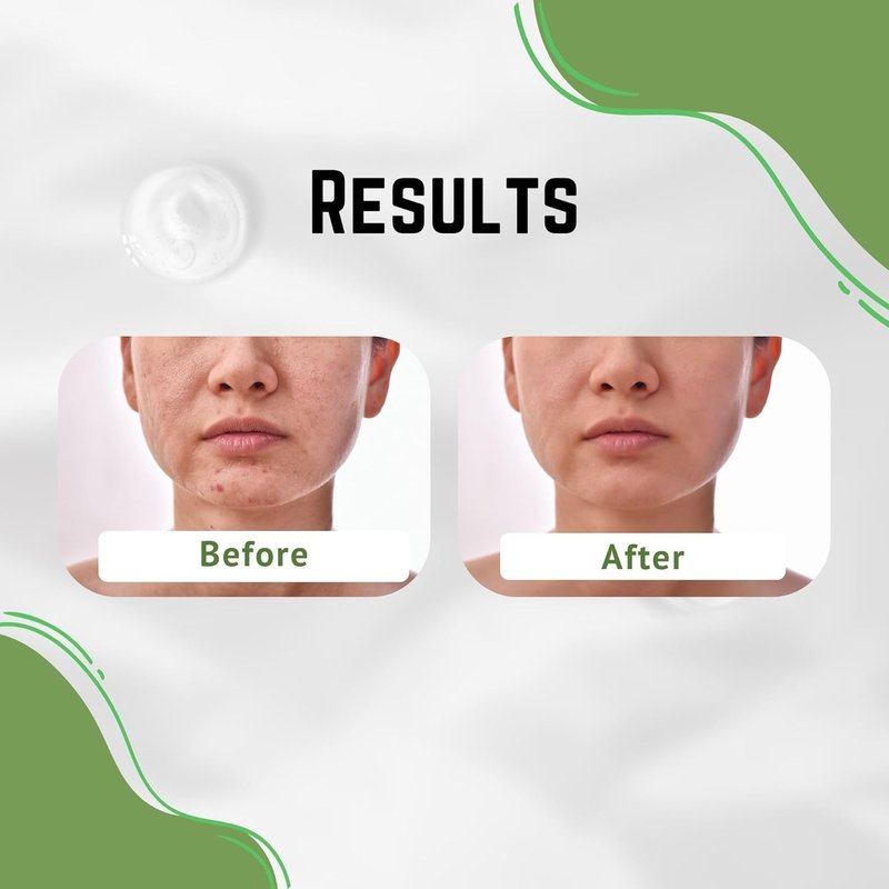 Aloe Vera Cream - Dark Spot Remover for Scars & Blemishes | Hydrating Face & Body Moisturizer for All Skin Types