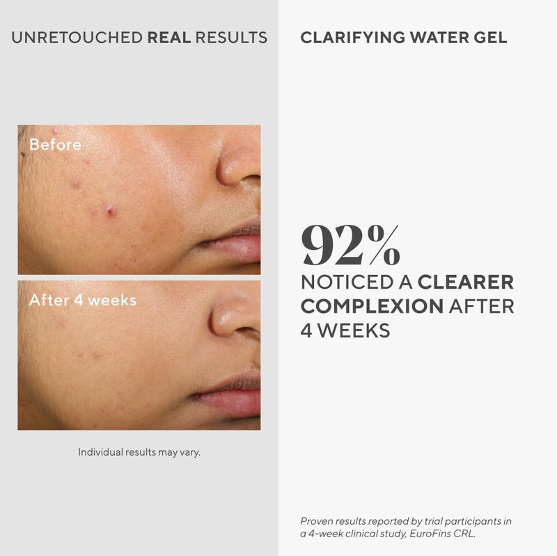 Murad Clarifying Water Gel – Lightweight Face Moisturizer for Acne-Prone Skin with Salicylic and Hyaluronic Acid for Breakout Prevention, Hydration, and Shine-Free Finish – 2 Fl Oz