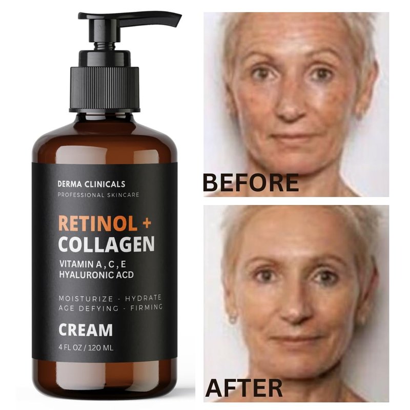 Retinol + Collagen Anti-Aging Face Cream | Hyaluronic Acid & Vitamin C Moisturizer - 4oz