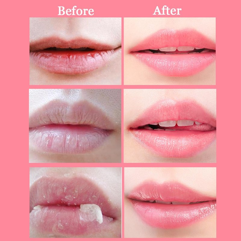 2 Pcs Bee Lip Balm Honey Pot, Honey & Strawberry Lip Mask Propolis