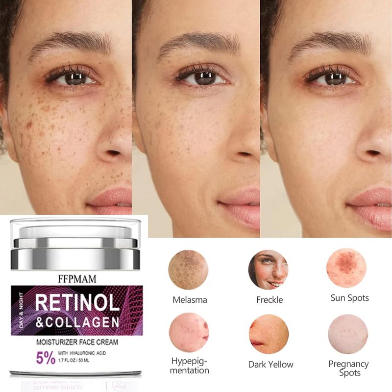 Retinol Cream for Face - Anti-Aging Wrinkle Treatment with Collagen & Hyaluronic Acid | Night Moisturizer for Men & Women (1.7 FL Oz)