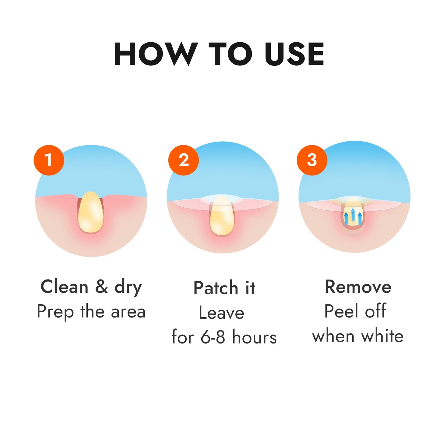 Epielle Acne Clear Patch Over-Zit - The Ultimate Hydrocolloid Solution of Acne Clear Patch (138 Ptches) Acne Pimple Patches Blemish Patches