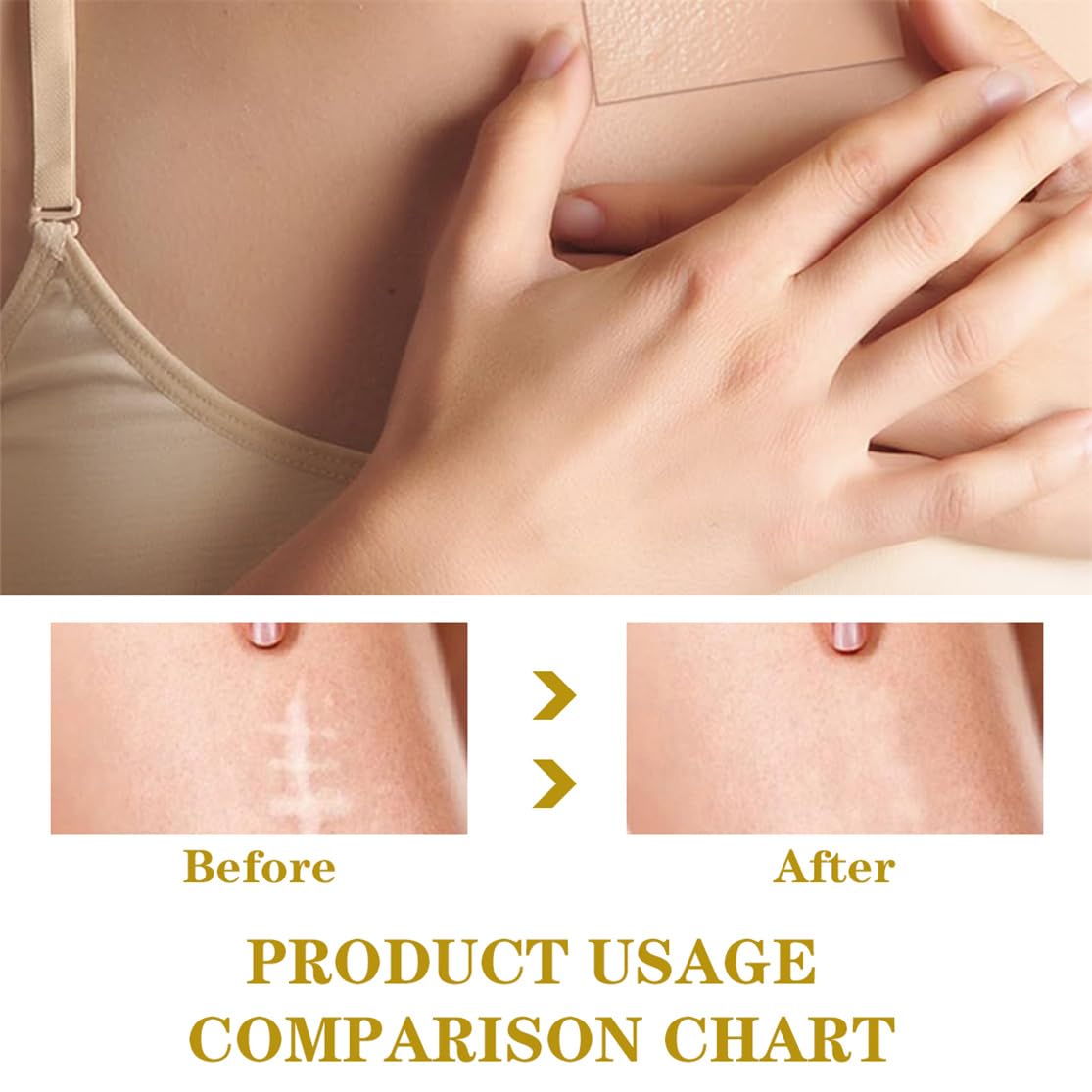 Silicone Scar Sheets, Scar Tape for Surgical 2inch X 118inch Silicone Skin Patches for C-Section Keloid Bump and Acne Scars Removal Treatment