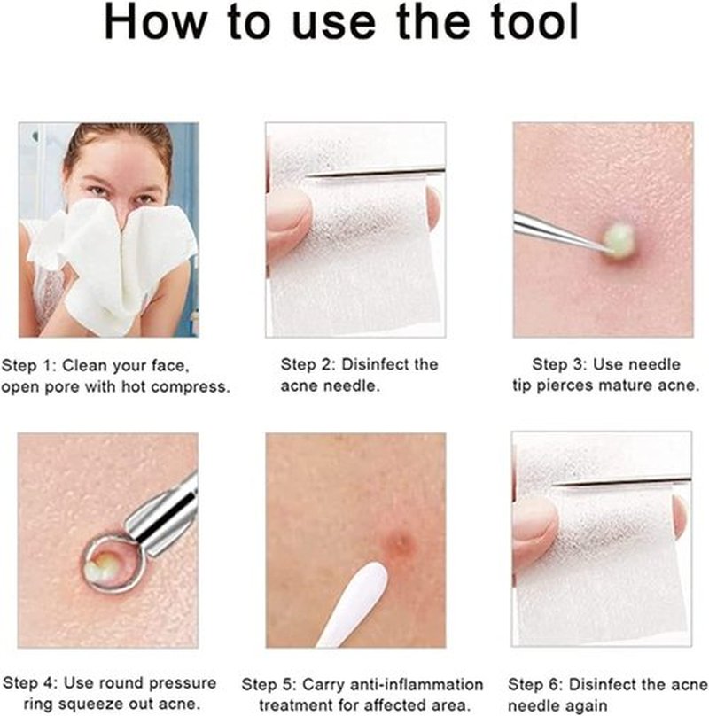 Usiveinborn Blackhead Remover, Usiveinborn Tweezers, Professional Facial Blackhead Remover Tweezers, Blackhead Remover Comedone Extractor (Straight-Mouth clamp)