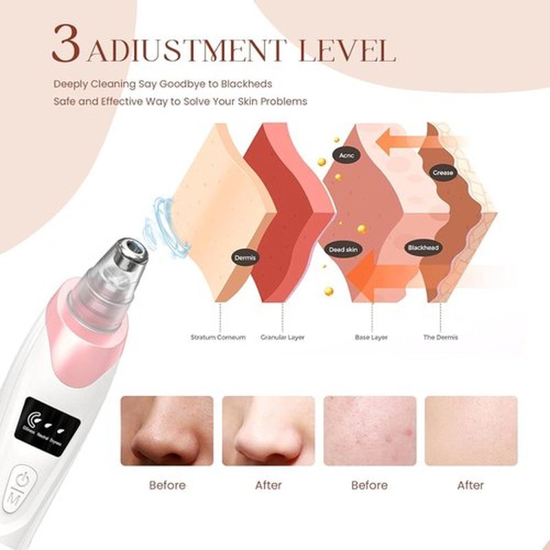 2024 Blackhead Remover Pore Vacuum,Facial Pore Cleaner-5 Suction Power,5 Probes,USB Rechargeable Blackhead Vacuum Kit Electric Acne Extractor Tool for Adult (Pink)