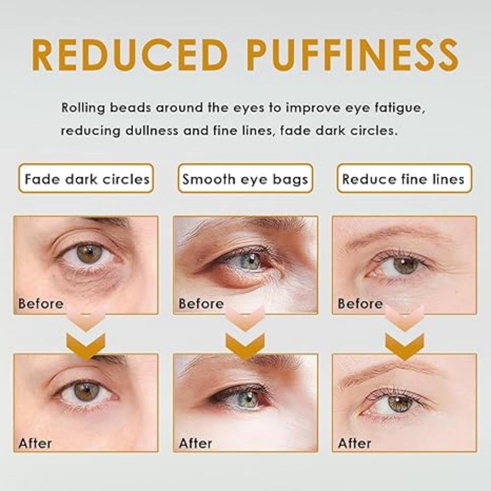 SWANNA 2 PCS Roller Ball Castor Oil,Castor Oil Frankincense Rollerball, Rollerball Castor Oil for Eyes, Bags Under Eyes,Fluffy and Reduce Swelling
