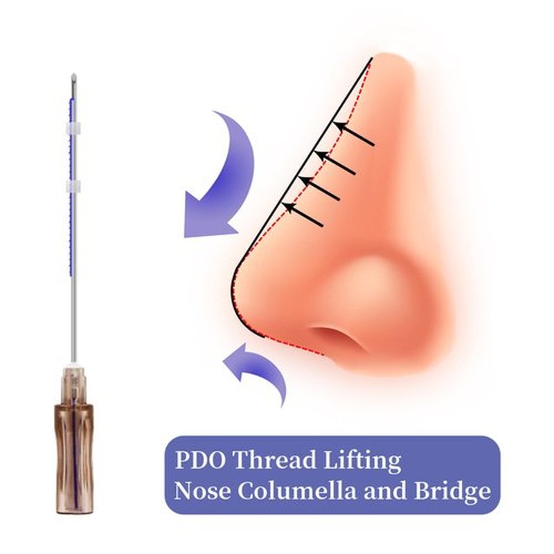 SOZOOM PDO Thread Nose Lift, PDO Cog Threads Improve the Shape of the Nasal Columella and Alar L-Blunt Type Cog Thread Lift (16pcs-19G-60mm (l))