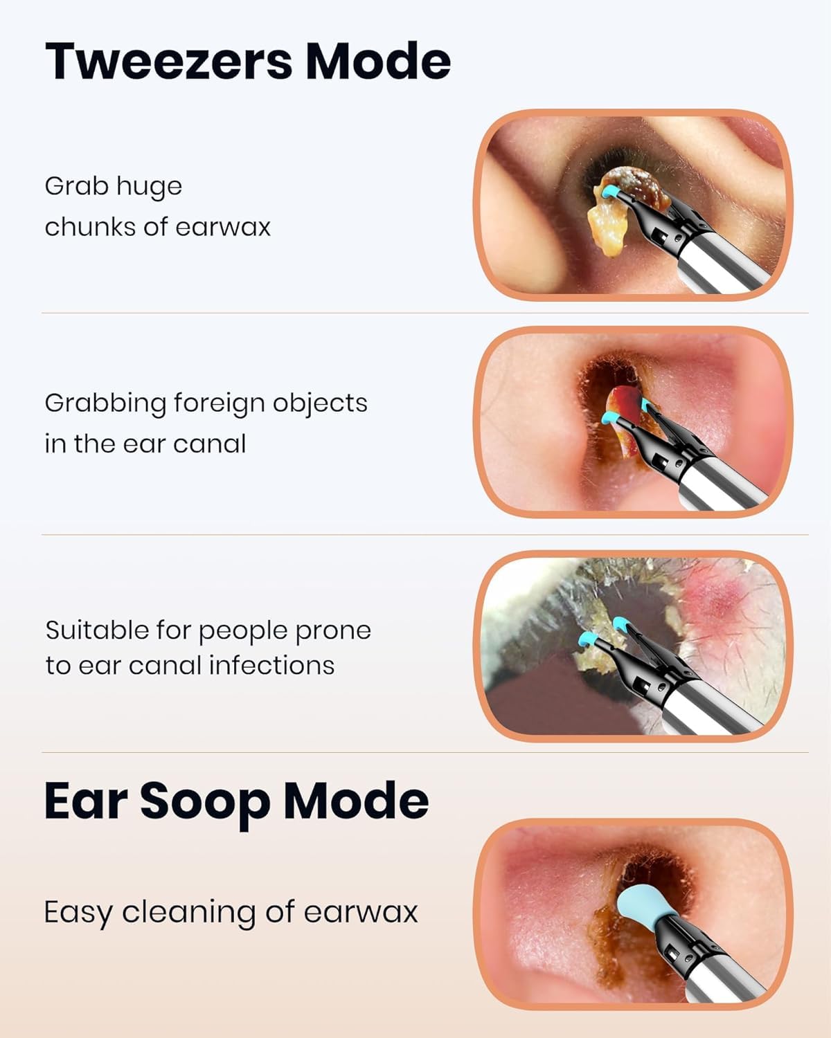 Ear Wax Removal Tool Camera: Ear Camera Otoscope, Bebird Note5 Pro Ear Cleaner Tweezers, 10 Megapixels Earscope Camera, Earwax Removal Kit, 12 Ear Spoon, Hygiene Storage Base, Wax Cleaning Kit (Blue)