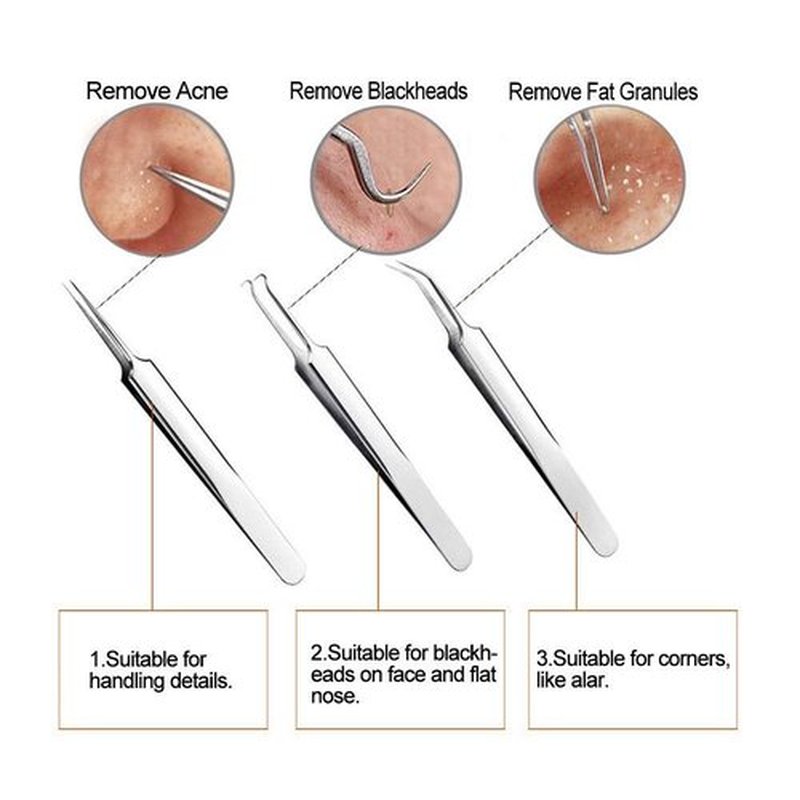 Blackhead Remover Kit - FEITA Blackhead Tweezers Removal Tool Kit Set - Acne Tweezers Pimple Comedone Extractor with Travel Case (5 Pcs)