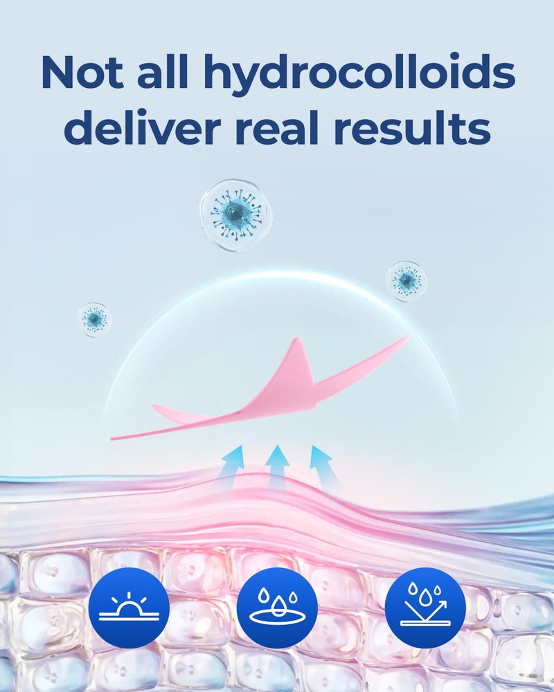 POINTMASS Star Pimple Patches for Face: Cute Acne Dots Hydrocolloid Stickers, Strong Absorption, 6 Colors, 312 Patches, Overnight Care
