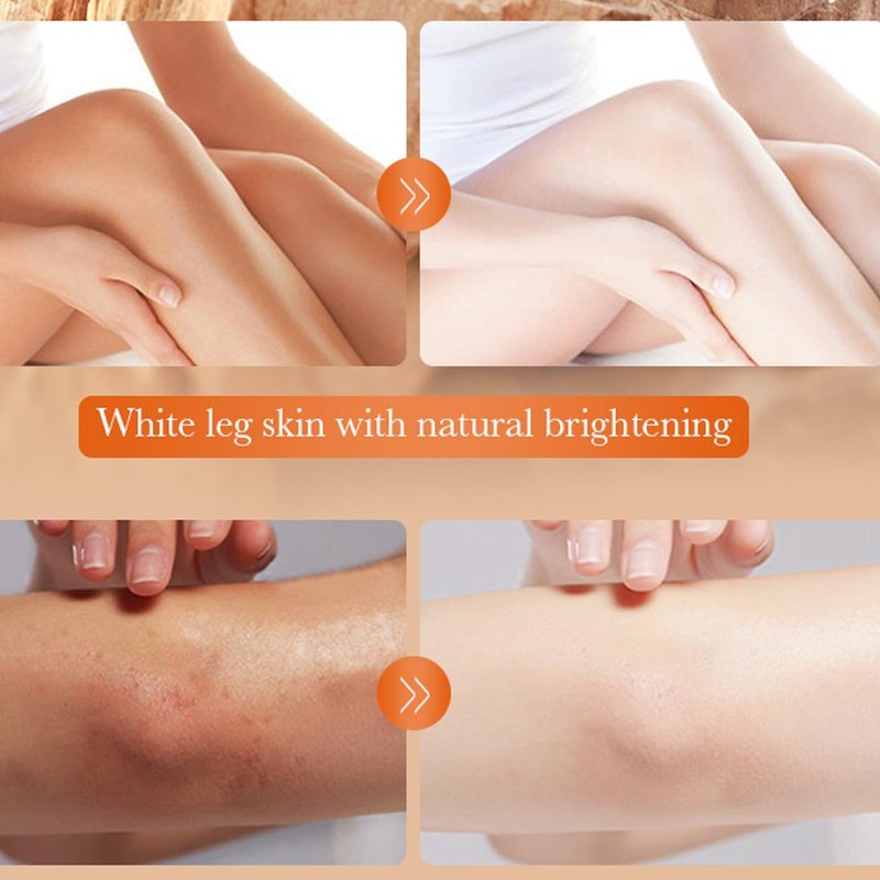 5.2oz Large Dark Knuckle Whitening Cream,Skin Bleaching For Dark Knees and Elbows,Body Moisturizing Strong Joint Whitening Cream for Clavicle,Neck,Niacinamide Vitamin C Dark Spot Corrector Remover