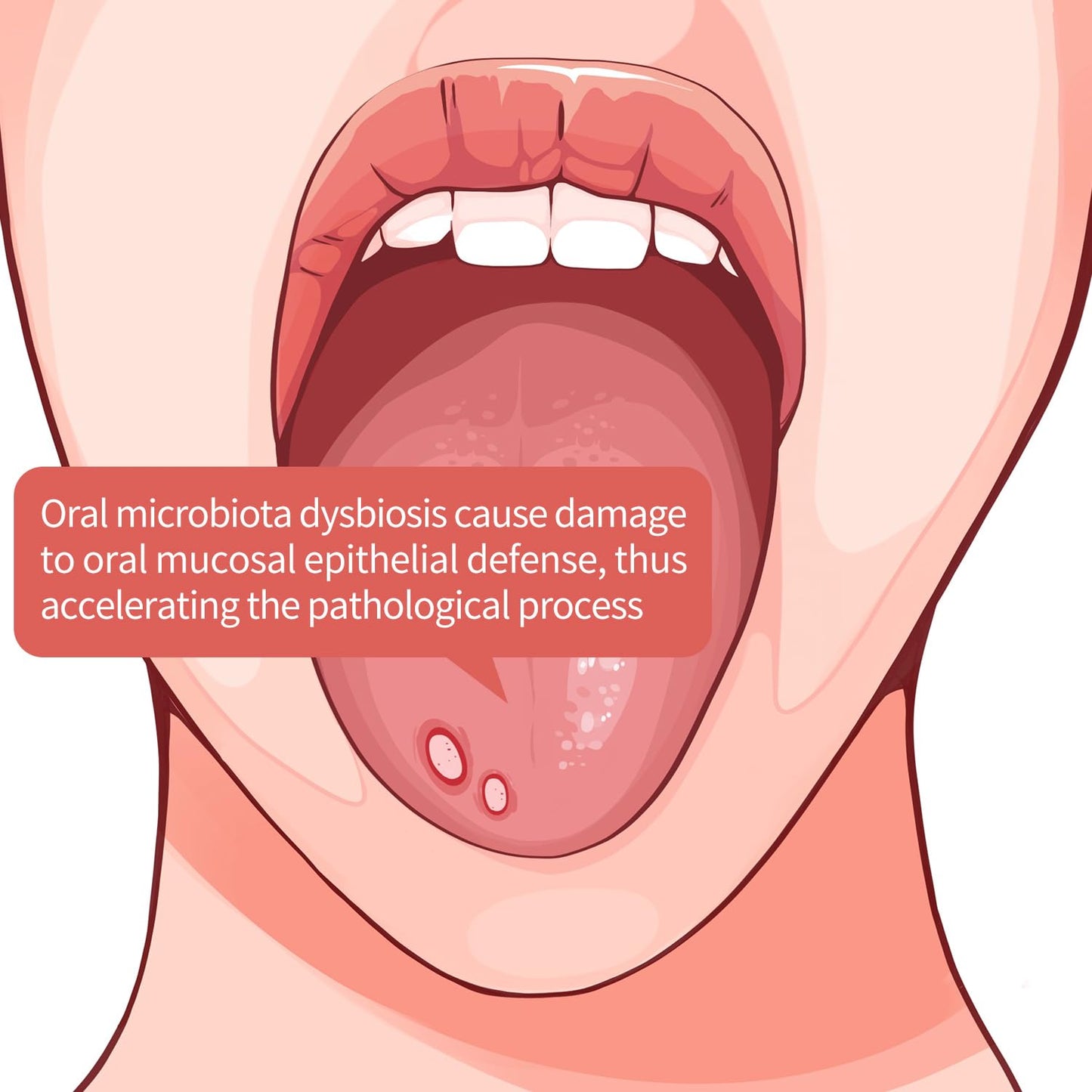 Tongueclear Oral Mucosal Cleaner|Silicon Oral Care Cleaner|Gum Massager with Air Bag(1 pc)