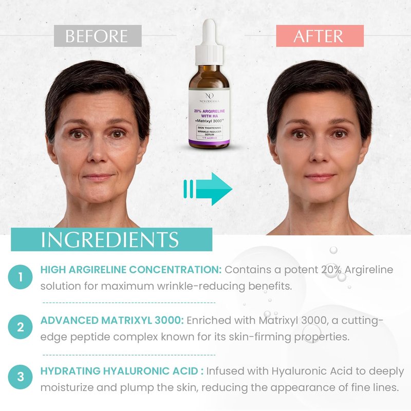 Nuvoderma Argireline Serum – 20% Argireline and Matrixyl 3000 - Face Serum Tightening with Hyaluronic Acid and Vitamin C – Lightweight Texture – 1 fl. oz.