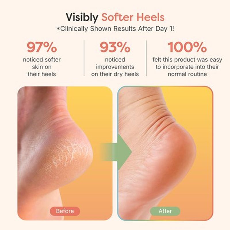 ZenToes Moisturizing Sleep Socks with Vitamin E, Olive Oil and Jojoba Seed Oil to Soften and Hydrate Dry Cracked Heels (Pink Hearts, Regular)