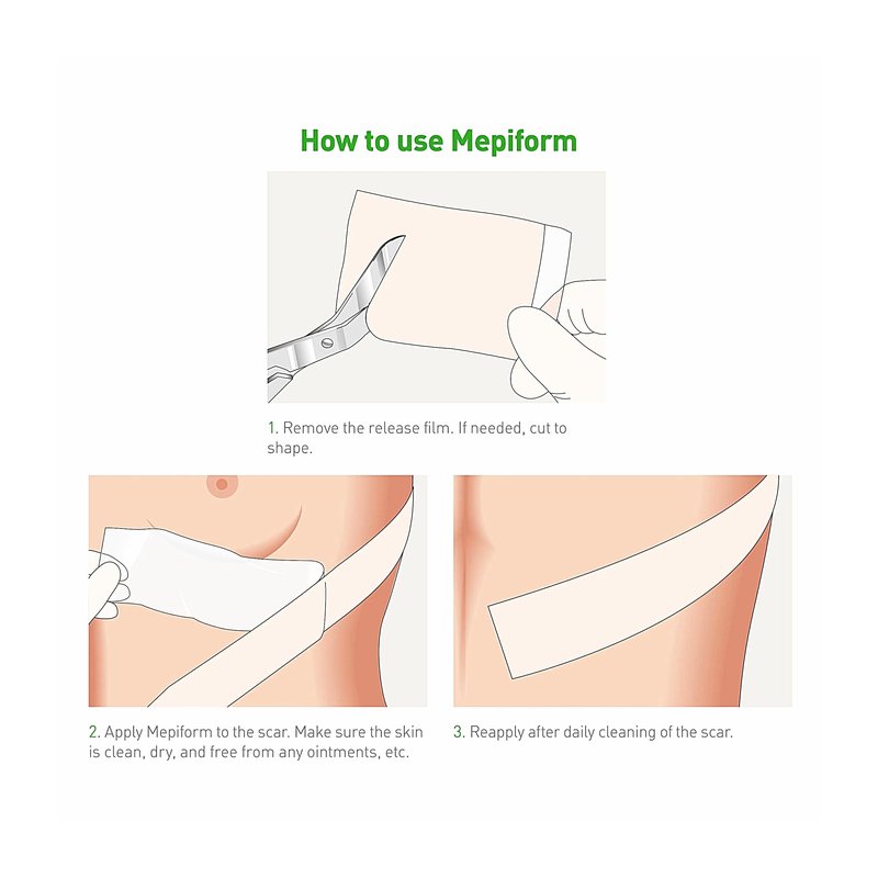 Mepiform 5x7.5 cm bandage 5 pcs