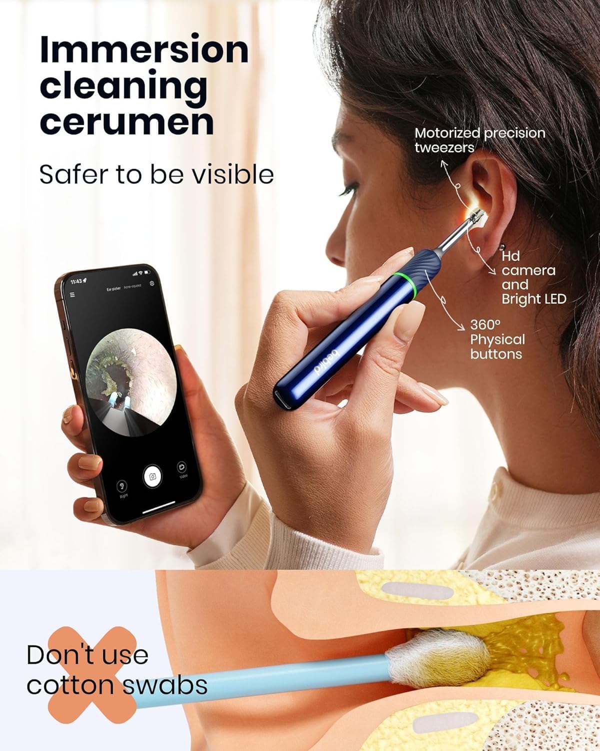 Ear Wax Removal Tool Camera: Ear Camera Otoscope, Bebird Note5 Pro Ear Cleaner Tweezers, 10 Megapixels Earscope Camera, Earwax Removal Kit, 12 Ear Spoon, Hygiene Storage Base, Wax Cleaning Kit (Blue)