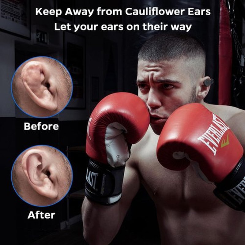 Cauliflower Ear Magnet - Effective Magnets Compression Kit - Prevention & Treatment of Hematomas & Keloid in BJJ, Wrestling, MMA, Grappling, Muay Thai, Rugby (Small, Middle and Large, Each 1 PCS)