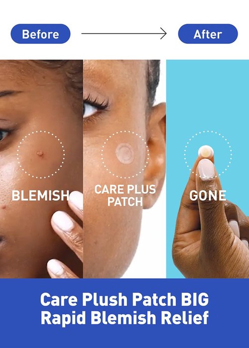 OLIVE YOUNG Care Plus Spot Patch 3 Pack | Hydrocolloid Acne Korean Spot Patch to Cover Zits, Pimple | Invisible Acne Patches for Troubled Skin (306 Count-10mm*216ea + 12mm*90ea)