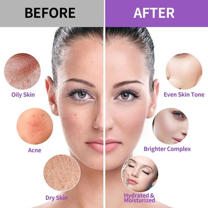 Nielies Jelly Mask, Facial Skin Care- Vampire Peel-Off Jelly Mask Set, Jelly Mask For Facials, Face Mask For Instant Hydration, Vegan Peel Off Face Mask, For Moisturizing, Smoothing (Lavender)