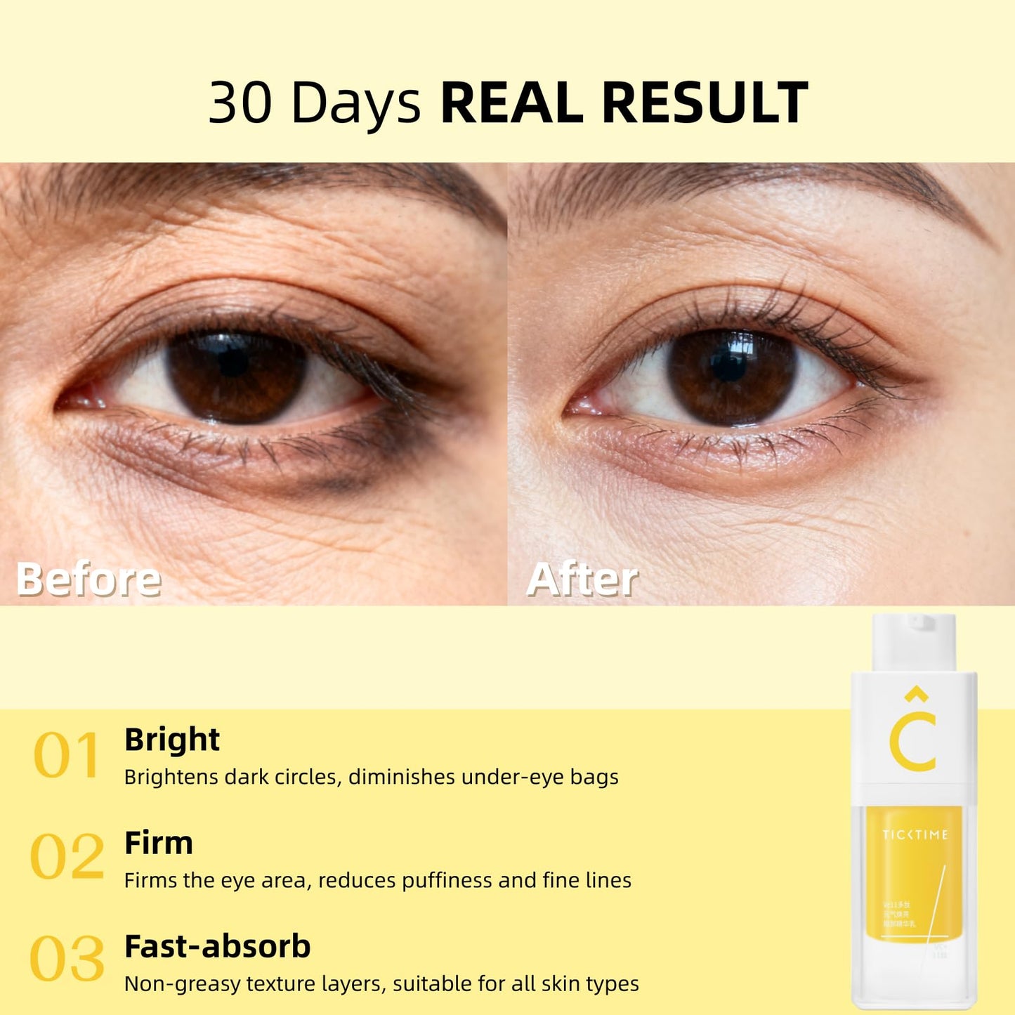 VC 11 Multi-Peptides Eye Serum 10% Triple Vitamin C & 11 Multi-Peptides for Dark Circles, Puffiness & Wrinkles, Sensitive-Skin Safe, 15ml