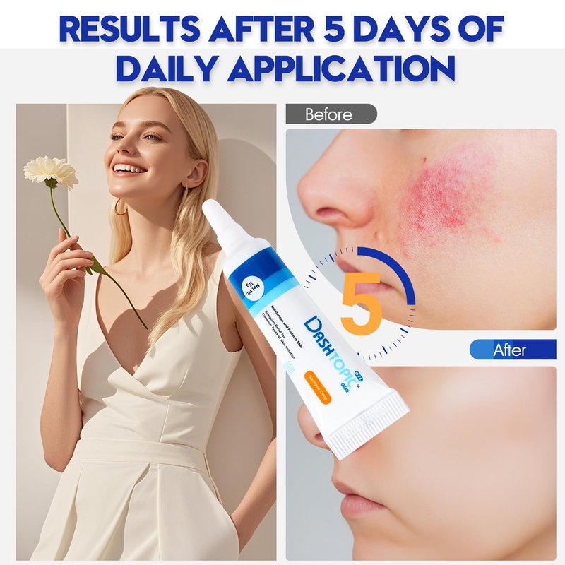 Eczema Relief Cream - Eczema Cream for Adults - Relief for Itchy, Red Skin & Repairs Skin Barrier - Sensitive & Dry Skin - Ideal for Eczema Rash, Radiation Repair, Daily Moisturizing (0.52 Oz)