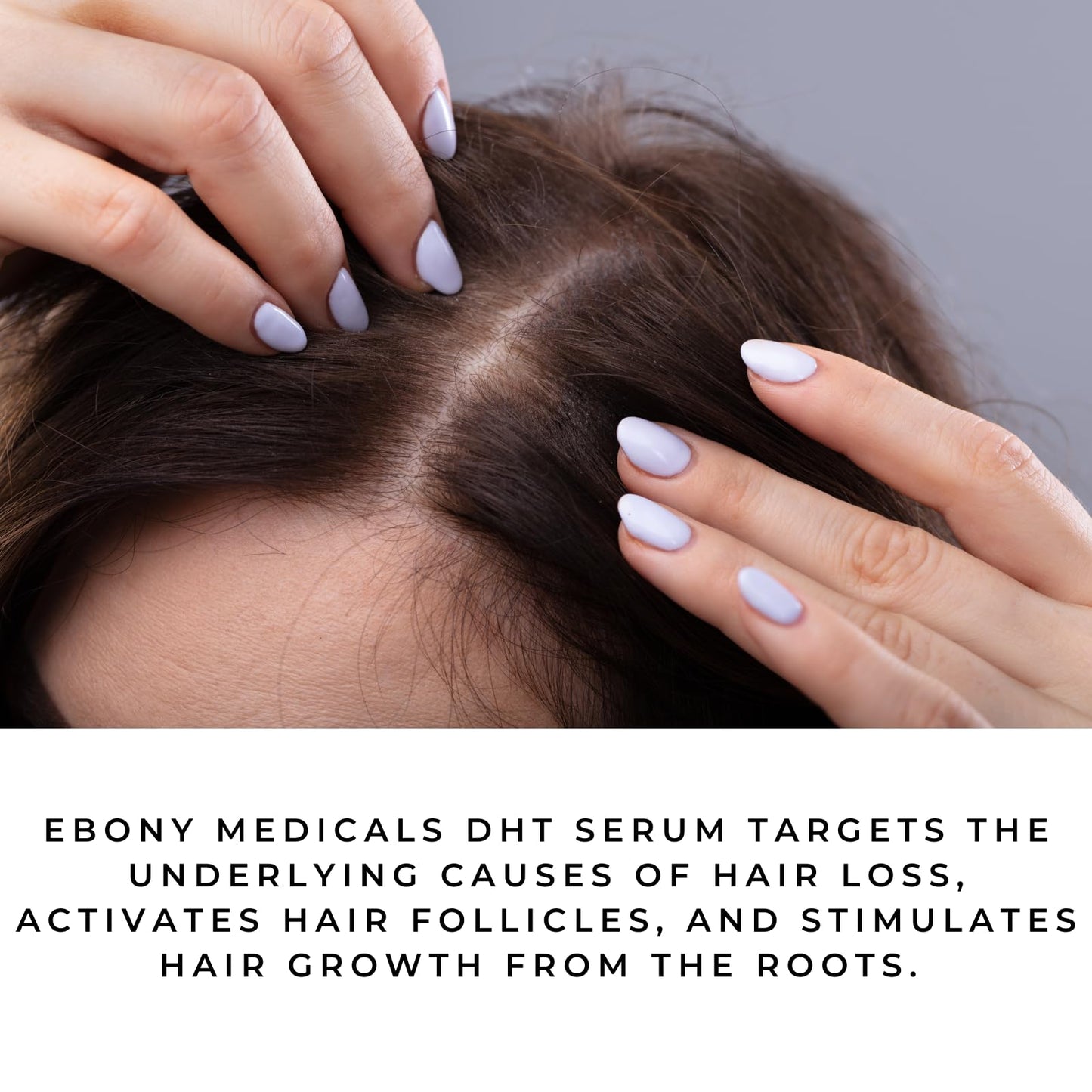 Ebony Medicals DHT Blocker Hair Growth Serum - Hair Loss Supplement, Supports Natural Regrowth, Fine Hair Thickening Serum 2 fl oz