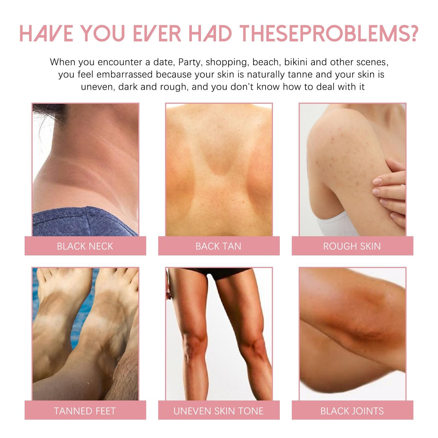 Crema Reparadora Para Manchas Oscuras 50ml, Crema íntima para mujeres, Adecuado para varias áreas como cara, axilas, cuello, zona privada 
