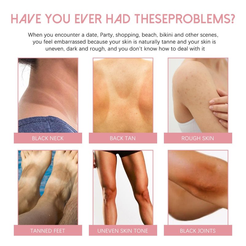 Crema Reparadora Para Manchas Oscuras 50ml, Crema íntima para mujeres, Adecuado para varias áreas como cara, axilas, cuello, zona privada 
