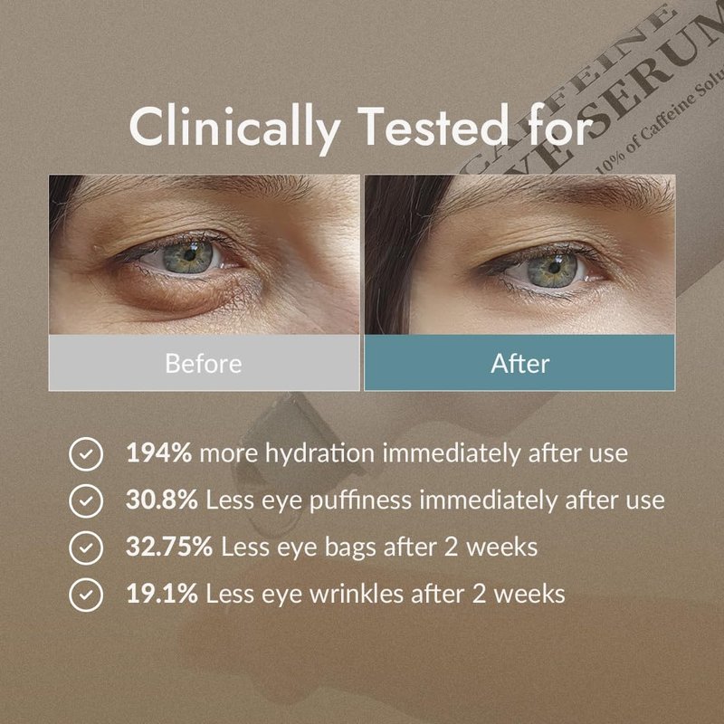 VILLAGE11FACTORY Hydro Boost Caffeine Eye Serum with 10% Caffeine Solution, Niacinamide, Hyaluronic Acid & Hexapeptide-8 for Depuffing, Elasticity, Dark Circle Treatment (0.33 fl.oz./10ml)