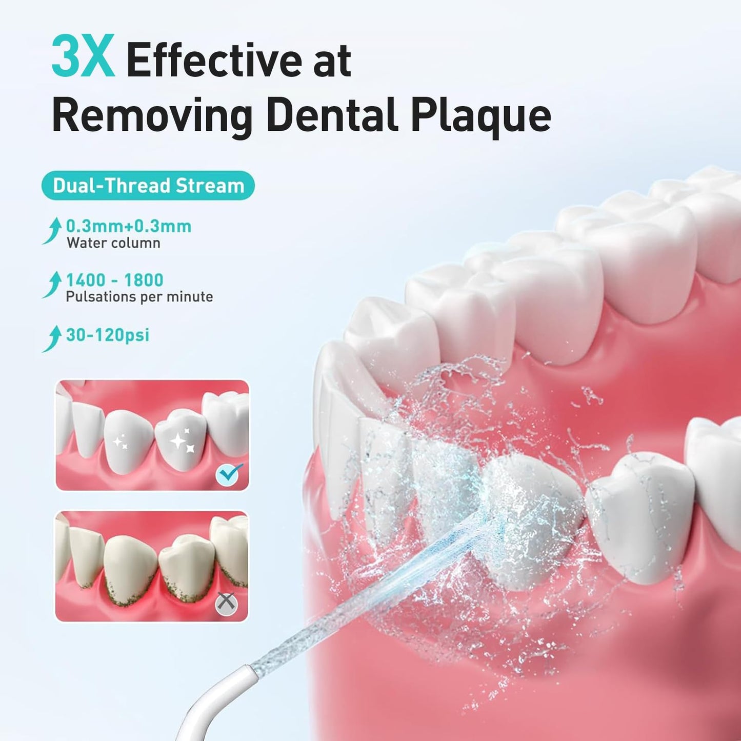 Water Dental Teeth Flosser Pick: 300ML Rechargeable Travel Irrigation Cleaner IPX7 Waterproof Portable Cordless Oral Irrigatorfor Teeth Cleaning with 1 Jet Tips White